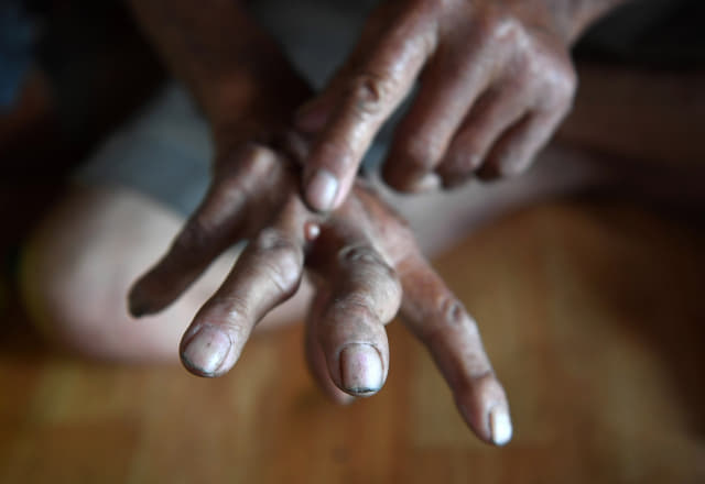 신판도씨가 93년간의 삶의 흔적이 고스란히 담긴 울퉁불퉁한 자신의 손을 보여주고 있다.